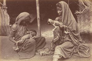 अकाल से पीड़ित बच्चे का जन्म